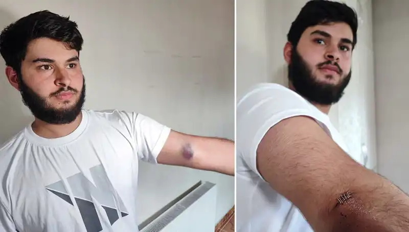 Mahallede Top Olayı: Conolar Kamyonetle Geldi, Herkes Şaşkın!